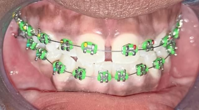 Paediatric and orthodontic care